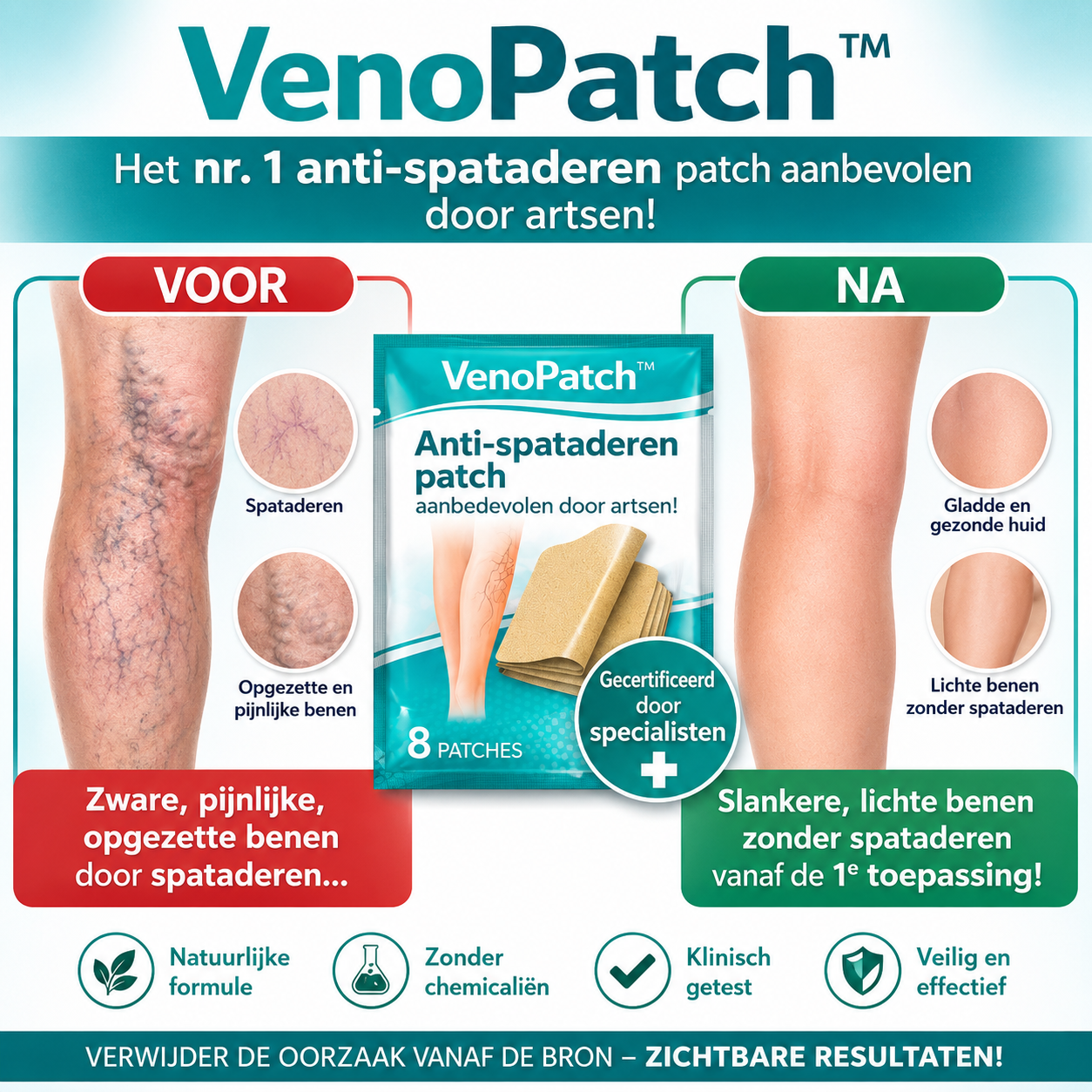 VenoPatch™ Anti-Spataderen Patch | Laat spataderen en beenpijn in 3 minuten verdwijnen!
